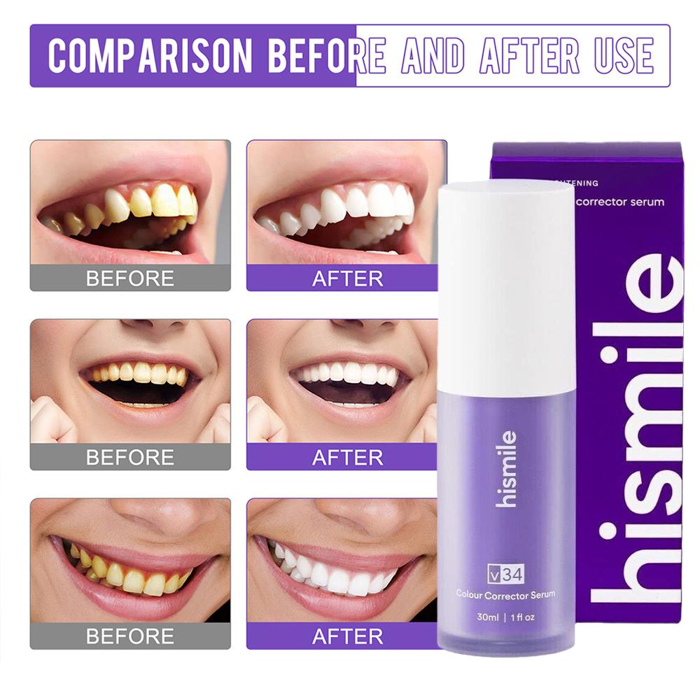 Teeth Paint Whitening - ยาสีฟันฮิสมายล์สีม่วง ฟันขาวสะอาด ปรับสีฟันให้สม่ำเสมอ ขจัดคราบฟัน เพิ่มความสดใส ลดความเหลือง
