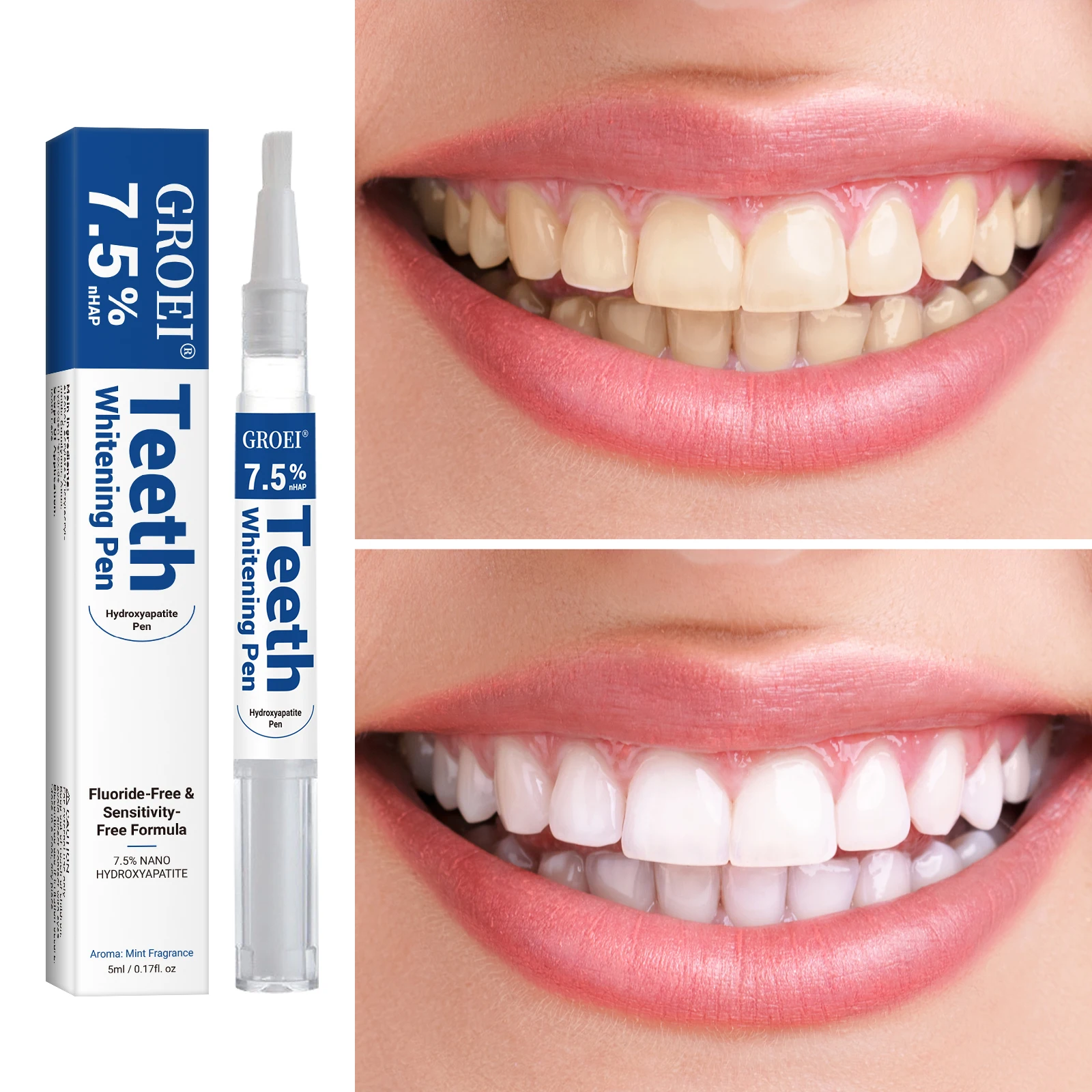 ปากกาฟอกสีฟันไฮดรอกซีอะพาไทต์  - Teeth Whitening Gel Pen บทวิจารณ์และราคา