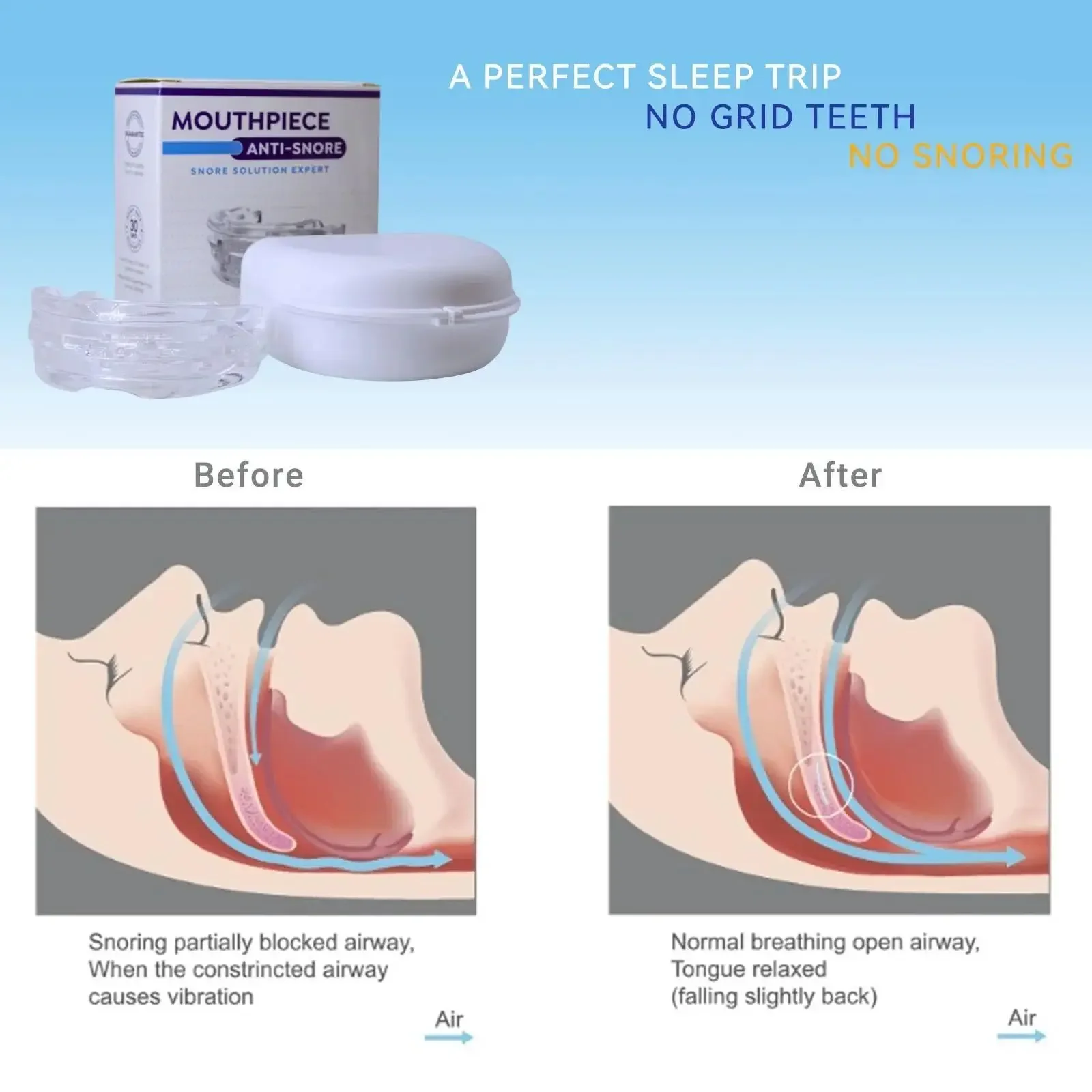 ที่ครอบฟันป้องกันการนอนกรนแบบป - Dental Guard Night บทวิจารณ์และราคา