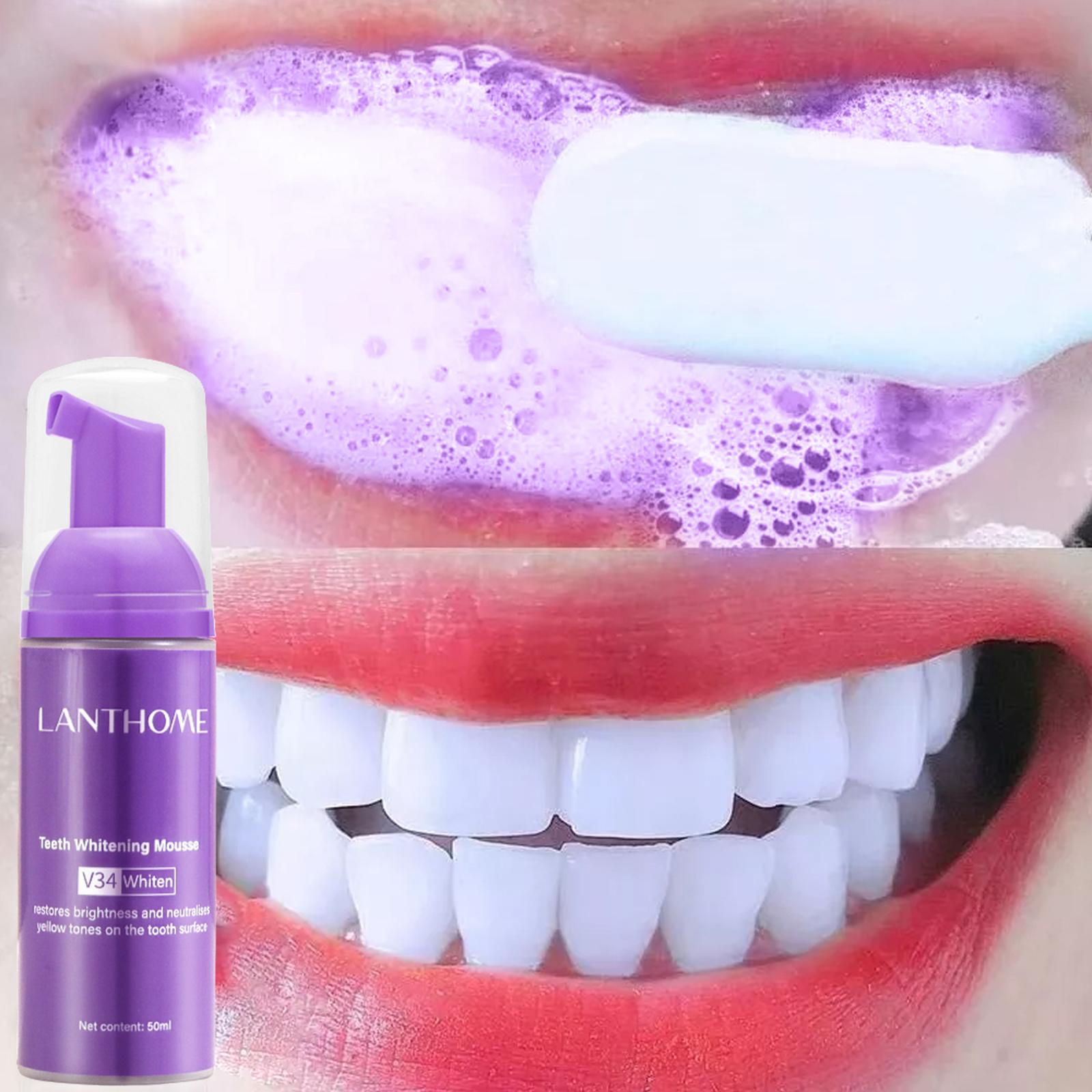 V34 มูสทําความสะอาดฟันยาสีฟันท - Teeth Whitening Effective บทวิจารณ์และราคา