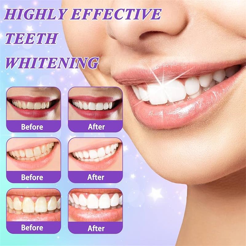ยาสีฟันมูสฟอกสีฟัน 9D สีม่วง ข - Teeth Whitening Treatment บทวิจารณ์และราคา