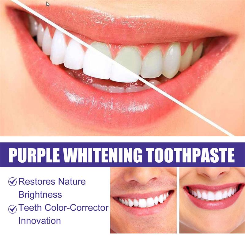 ยาสีฟันมูสฟอกสีฟัน 9D สีม่วง ข - Teeth Whitening Treatment บทวิจารณ์และราคา