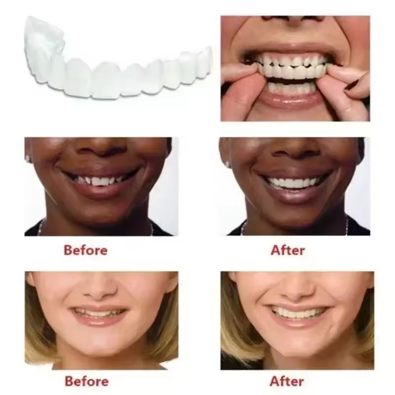 วีเนียร์ฟัน ฟอกสีฟัน ฟันปลอม ท - Teeth Whitening Kit บทวิจารณ์และราคา
