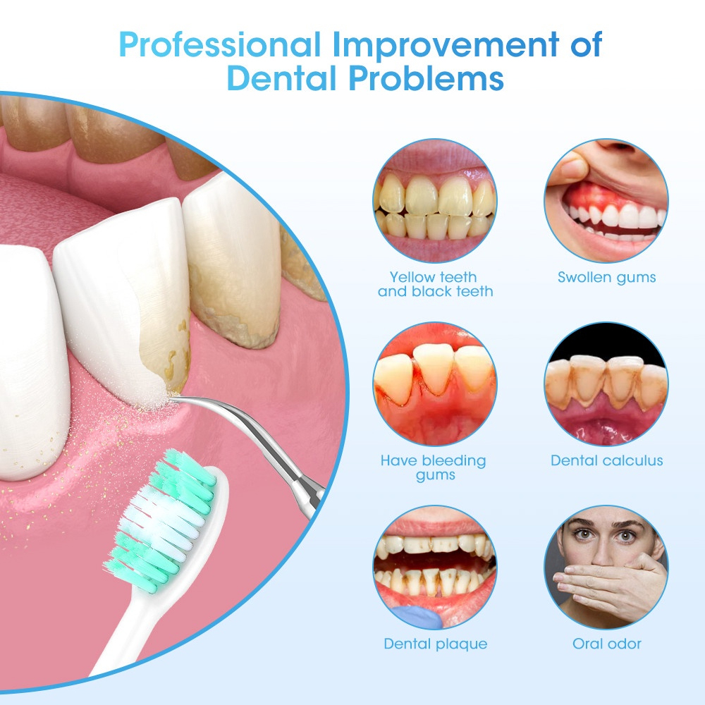 เครื่องขูดหินปูนไฟฟ้า LC-H156X - Teeth Whitening And Stain Removal บทวิจารณ์และราคา