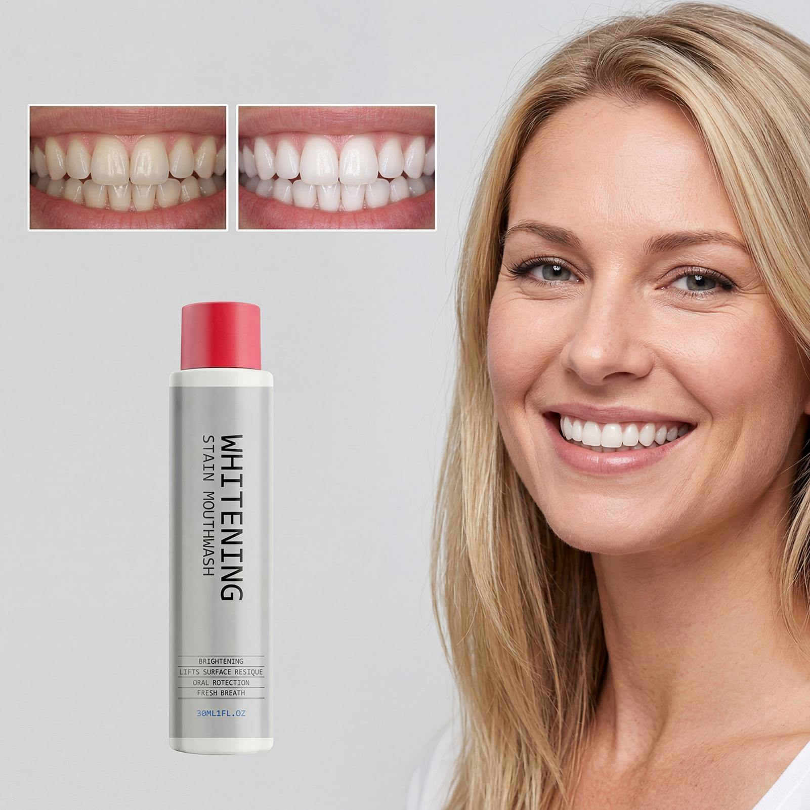 น้ำยาบ้วนปากขจัดคราบ 30 มล. ช่ - Teeth Whitening And Stain Removal บทวิจารณ์และราคา