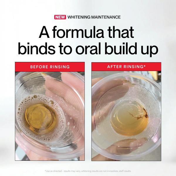 ฮิสไมล์ ไอดี ไวท์เทนนิ่ง สเตน  - Teeth Whitening With Peroxide บทวิจารณ์และราคา