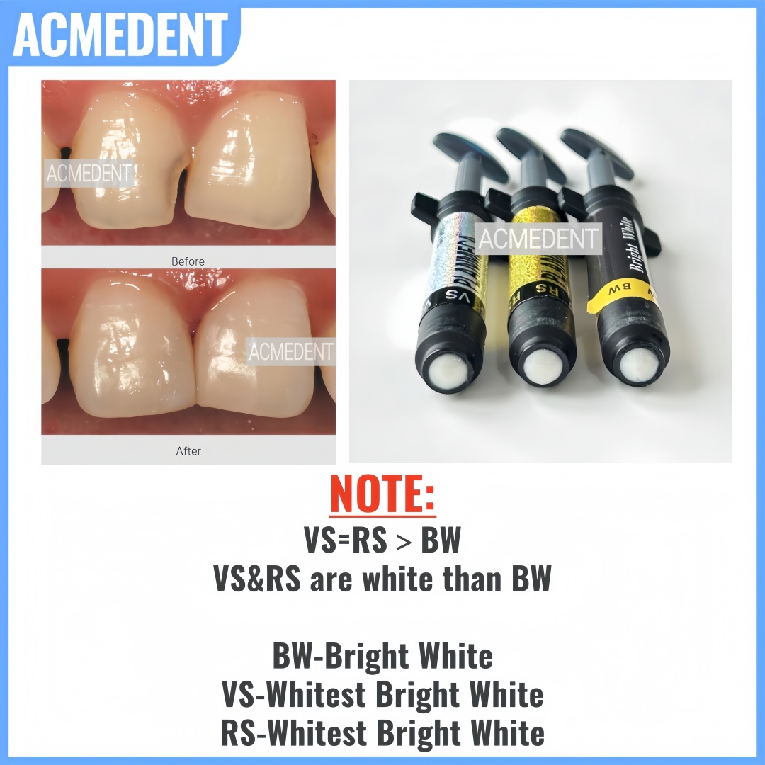 4.5g ทันตกรรมเรซินคอมโพสิตวีเน - Teeth Whitening Vs Veneers บทวิจารณ์และราคา