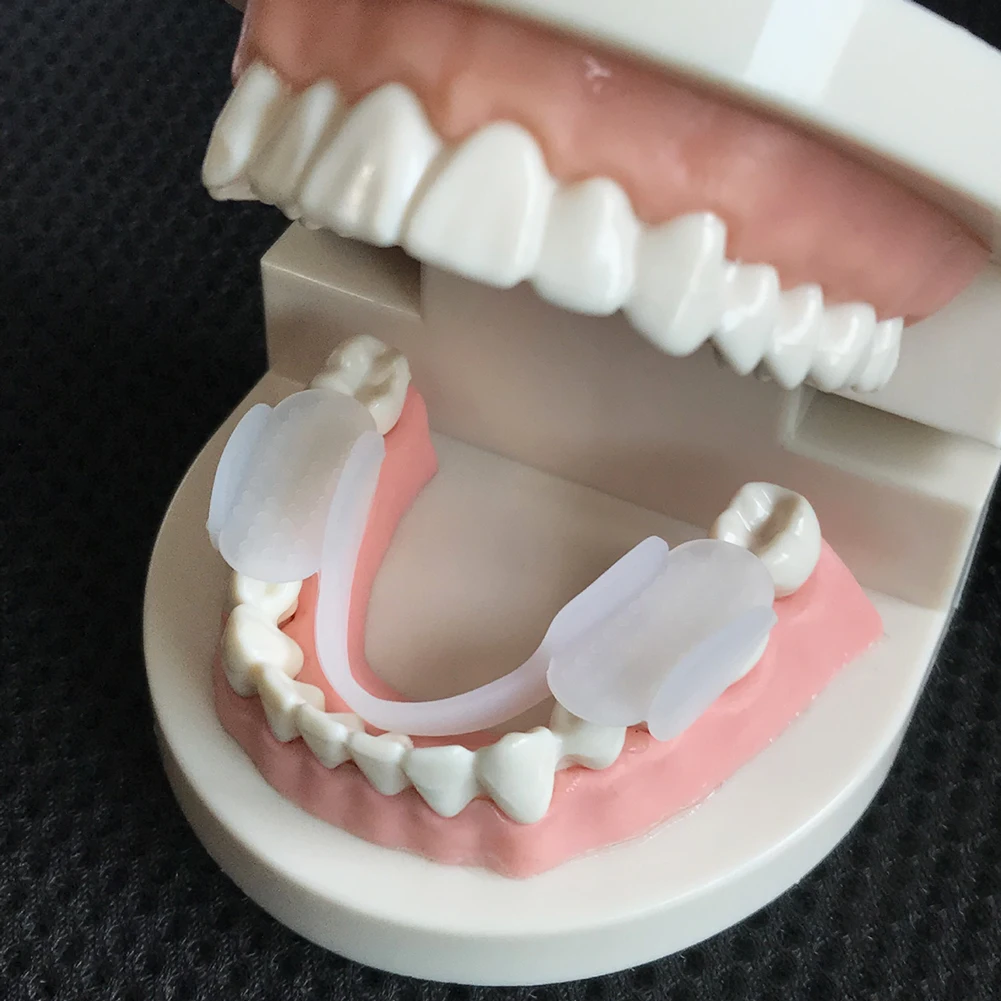 2 ชิ้นฟัน Splint Protector Sof - Dental Guard Night บทวิจารณ์และราคา