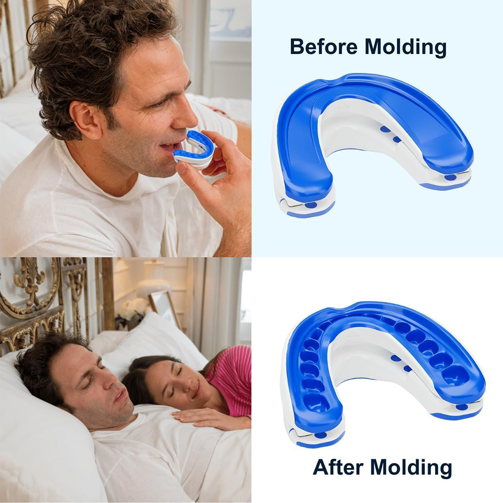 Anti-Snoring Mouthpiece Anti-S - Dental Guard Night บทวิจารณ์และราคา