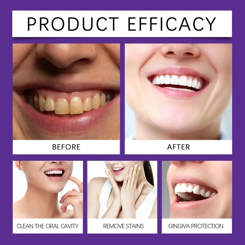 ผงแร่ฟื้นฟูฟันสีม่วง ผงยาสีฟัน - Teeth Paint Whitening บทวิจารณ์และราคา