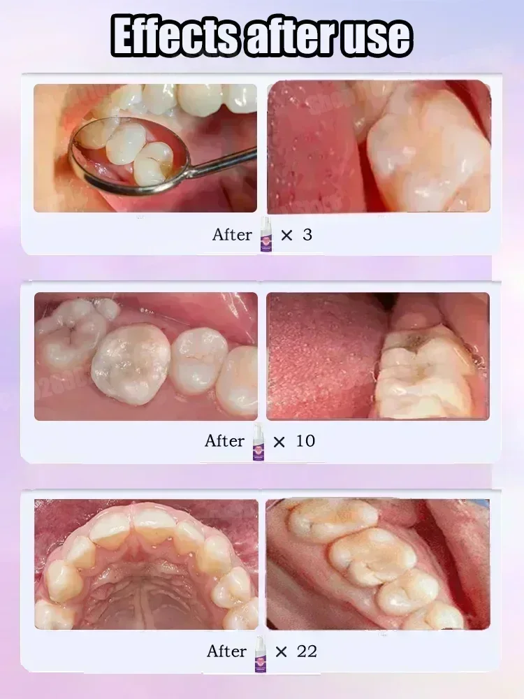 ยาสีฟันทำความสะอาดฟัน ขจัดคราบ - Teeth Whitening Treatment บทวิจารณ์และราคา