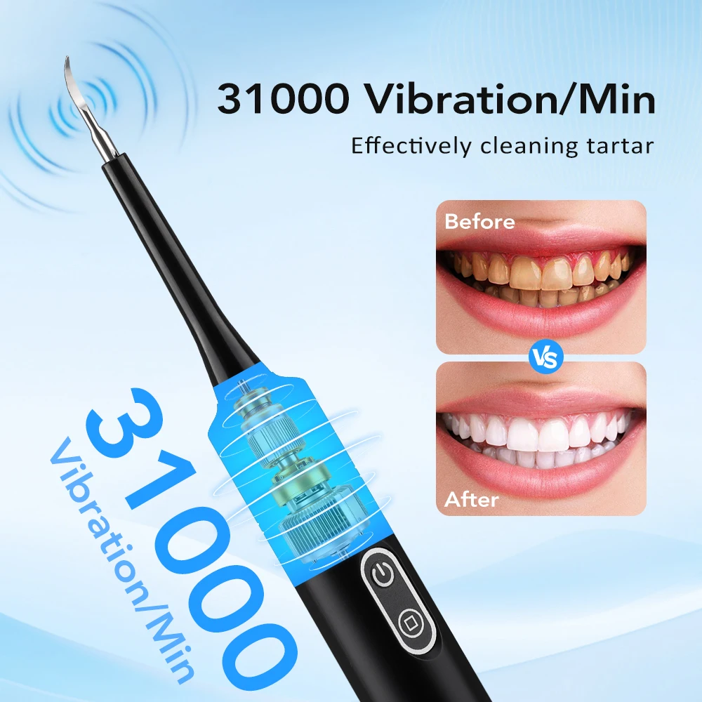 เครื่องขจัดคราบหินปูนไฟฟ้าแบบส - Teeth Whitening And Stain Removal บทวิจารณ์และราคา